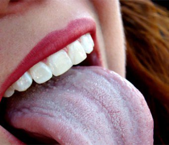 Revestimento branco na boca