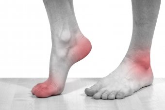 걷는 중 발의 통증 : 원인 및 치료