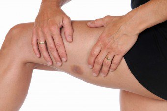 脚の痛み：教育と治療法の原因