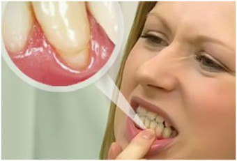 Vad händer om tänderna kliar?