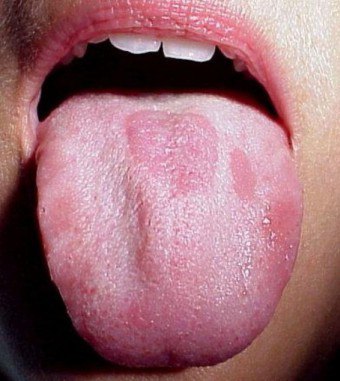 Apakah lidah dalam bahasa itu, dan mengapa ia muncul?