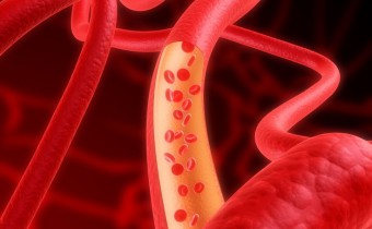 Anemia cronică: cum este diagnosticată și ce se întâmplă?