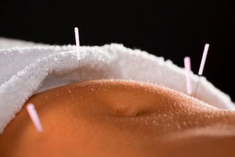 Niepłodność w akupunkturze: niekonwencjonalna, ale skuteczna metoda leczenia
