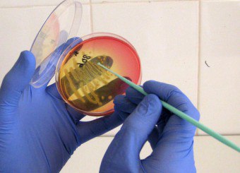 التحقيق في البكتيريا الدقيقة من الحلق - طريقة دقيقة لتشخيص العدوى