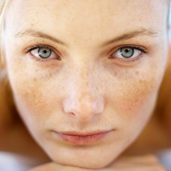 Perubahan dalam kualiti kulit: apakah bukti bintik merah jambu pada kulit?