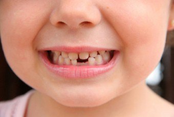 Cum să dureze un dinte al copilului fără durere
