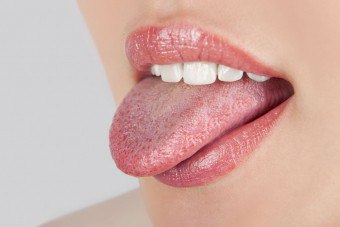 Hur bli av med blåsor i tungan?