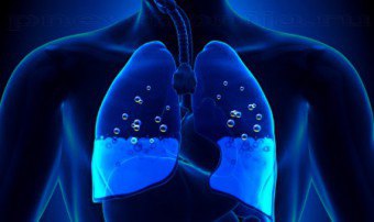 Hur bli av med vätska i lungorna?