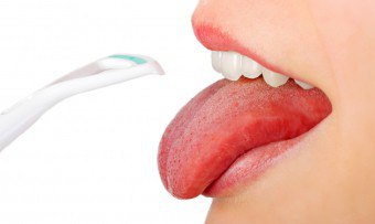 습격에서 혀를 치우고 건강한 모습으로 회복시키는 방법?