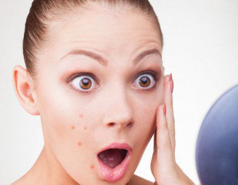 Como tomar "Metronidazol" da acne?