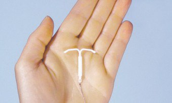 Ako funguje intrauterinná antikoncepčná špirála