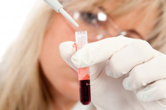Hvordan dechifiseres blodprøven for toksoplasmose?