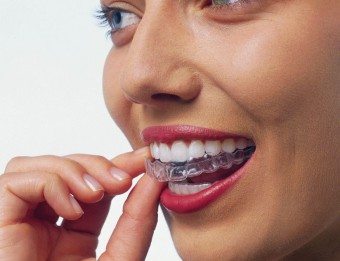 Hvordan rette tennene dine hjemme uten å bruke armbånd?