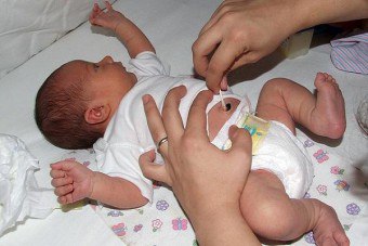 När en nyfödds navelsträng faller och hur ska man ta hand om det korrekt?