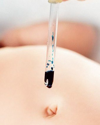 Bilakah tali pusat bayi baru lahir dan bagaimana untuk menjaga dengan betul?