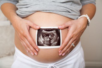 Viacnásobné tehotenstvo: monochorionické a dichorické dvojčatá
