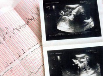 จำเป็นต้องทำ CTG ในครรภ์หรือไม่?
