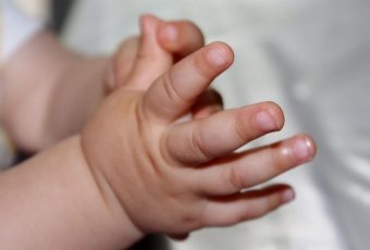 피부가 아기의 손가락에 벗겨짐 - 병리학의 10 가지 공통 원인