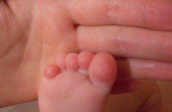 Por que a pele fica entre os dedos das mãos e dos pés da criança? Causas e formas de combater a doença