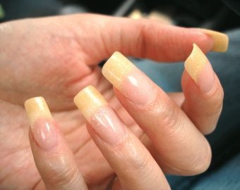 Varför blir mina naglar gul?