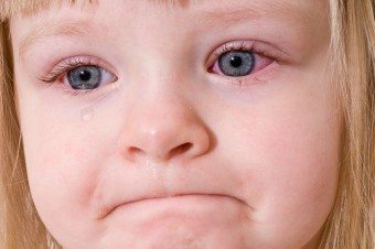Vaiko akių paraudimas. Šio simptomo priežastis ir jo kovos būdai