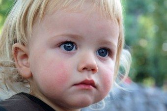 Sčervenanie očí dieťaťa. Príčiny tohto príznaku a spôsoby boja proti nemu