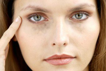 Årsaker og metoder for fjerning av svarte flekker under øynene