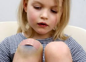 아이의 다리에 상처 : 출현의 원인, 싸우는 방법, 예방 조치