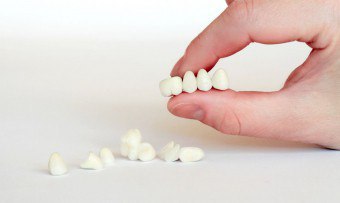 Zlomený zub nie je problém: skúmame moderné metódy protetiky