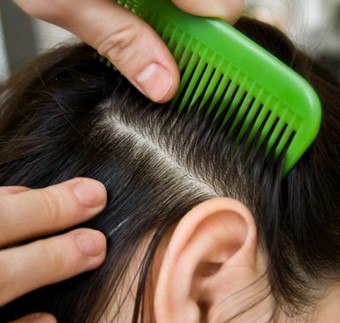 Căderea părului cu bulb: cauze și tratament