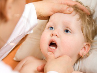 Estomatite ulcerativa em crianças - como e como ajudar a criança?