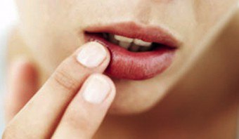 顔の最も魅惑的な部分の病気： "問題"唇