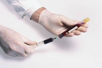 Зашто узети крвни тест за глукозу: карактеристике процедуре и нормалне параметре